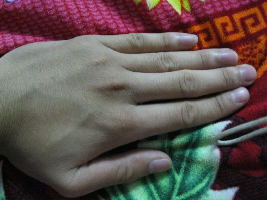 [Ảnh: IMG_0383.jpg]