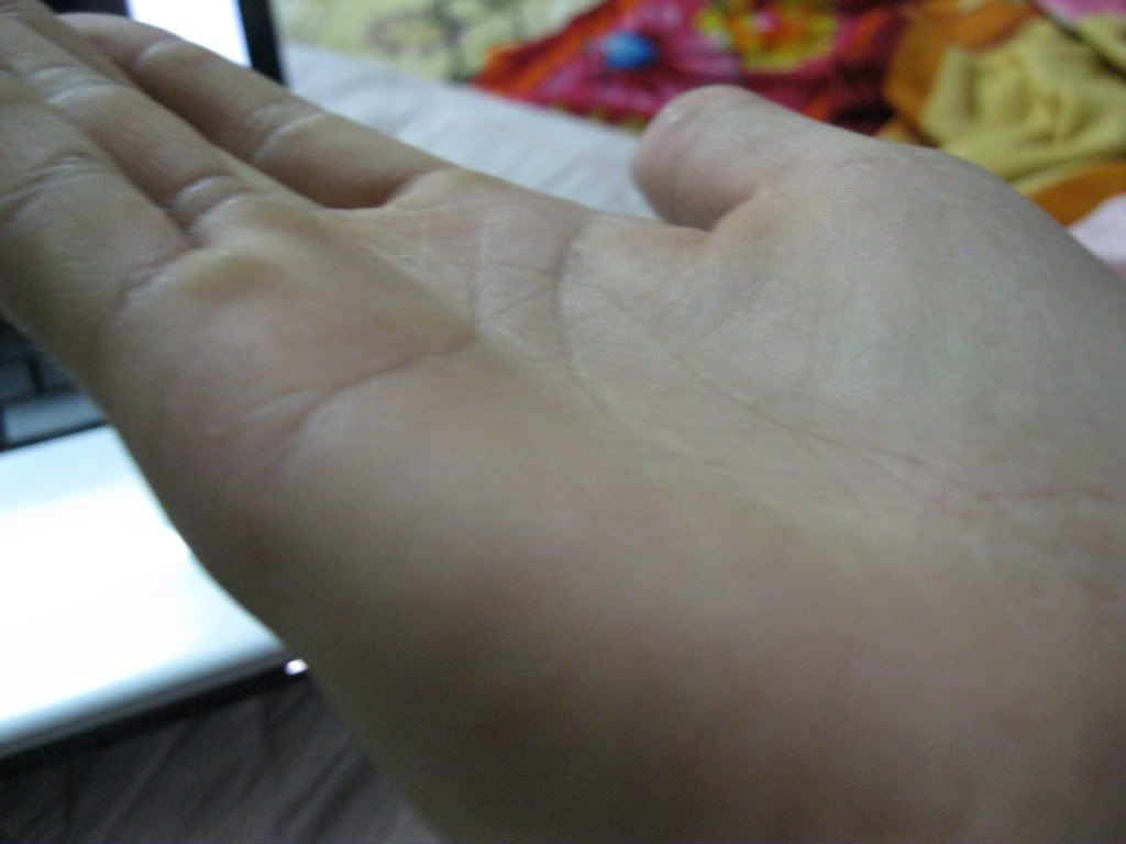 [Ảnh: IMG_0400.jpg]